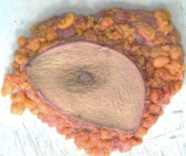 Description of the image